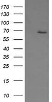 ER Alpha / Estrogen Receptor Antibody (clone OTI2E10)