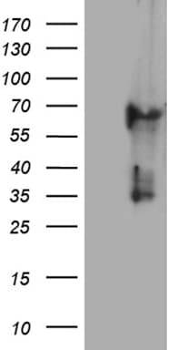 Monoclonal Mouse anti-Human KRT84 / Keratin 84 / KRTHB4 Antibody (clone OTI2D1, IHC, WB)