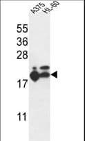 RPL17 / Ribosomal Protein L17 Antibody (aa156-184)