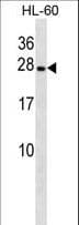 Polyclonal Rabbit anti-Human PGRMC2 Antibody (aa192-221, WB)