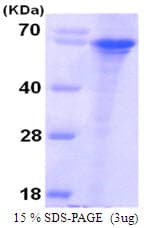 Human SNPH Protein (Recombinant His)