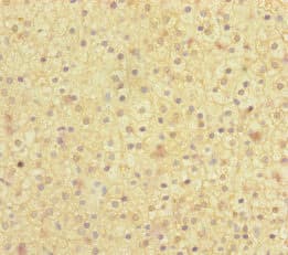 Polyclonal Rabbit anti-Human MOCS2 Antibody (IHC, IF, WB)