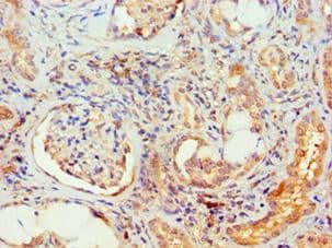 Polyclonal Rabbit anti-Human MAPK13 / p38delta Antibody (aa1-365, IHC, WB)