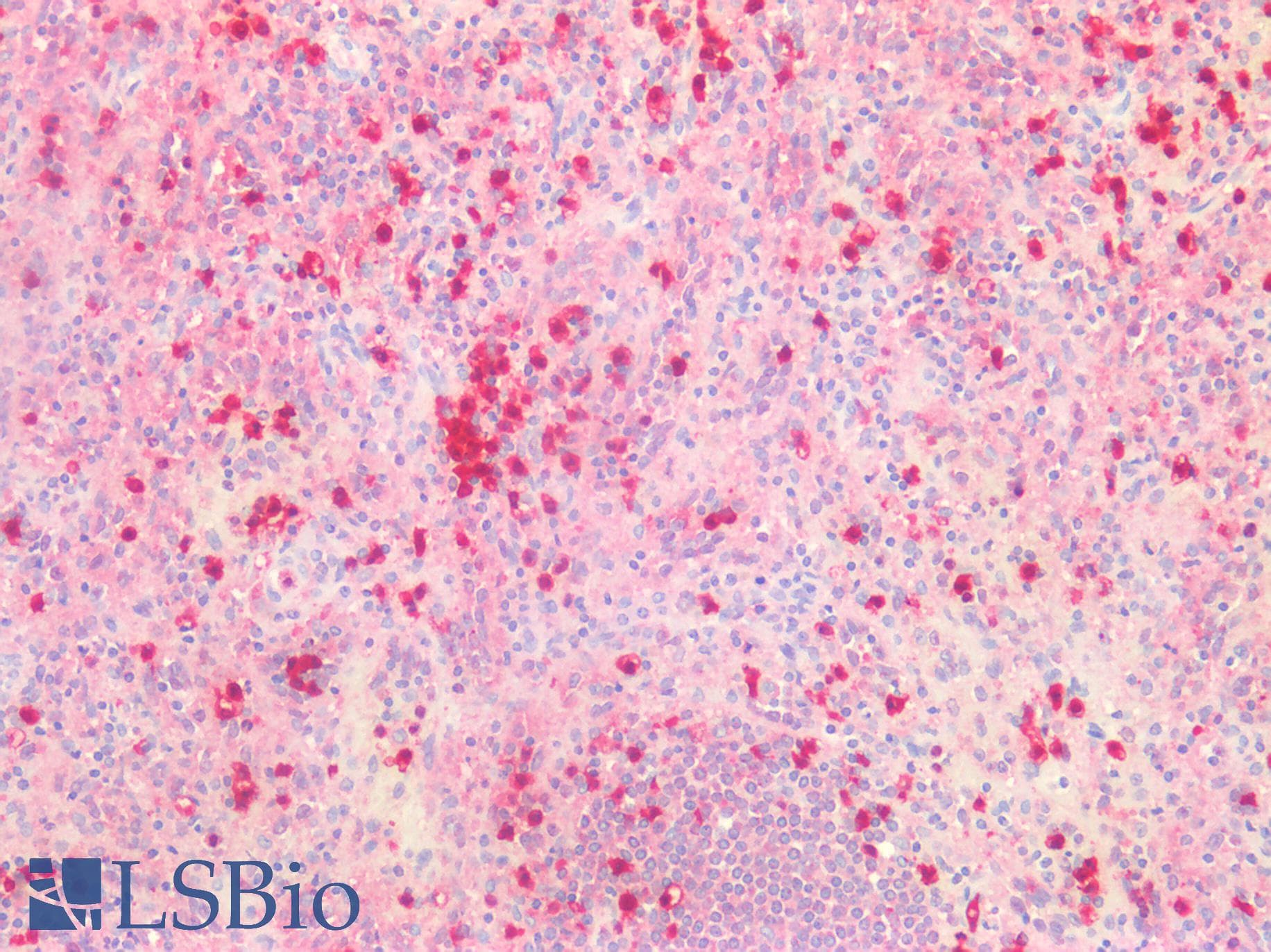 PathPlus™ CDA / Cytidine Deaminase Antibody
