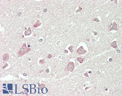 IHC-plus™ CBFA2T2 / MTGR1 Antibody