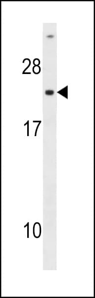 CMPK / CMPK1 Antibody (aa132-162)
