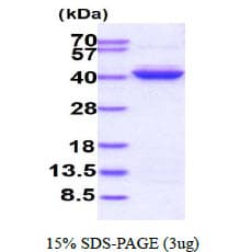 Human PCA1 / ALKBH3 Protein (Recombinant His)