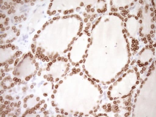 MED15 / ARC105 Antibody (aa393-679, clone OTI1C11)