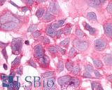 IHC-plus™ HRH3 / Histamine 3 Receptor Antibody (Cytoplasmic Domain)