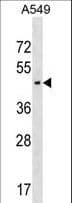 Polyclonal Rabbit anti-Human AGPAT5 Antibody (aa28-55, WB)