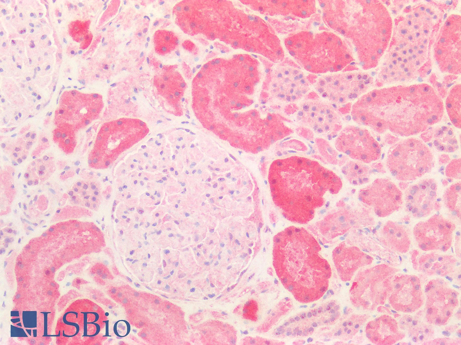 IHC-plus™ ADAM10 Antibody
