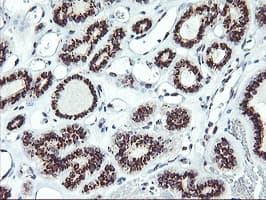 SQSTM1 Antibody (clone OTI5D5)