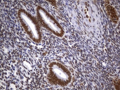 Monoclonal Mouse anti-Human MSH2 Antibody (clone UMAB259, Carrier-free, aa1-304, IHC)