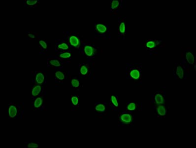 HIST1H1C Antibody
