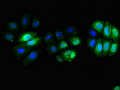 Polyclonal Rabbit anti-Human CD3E Antibody (IHC, IF)