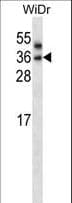 PNPLA4 Antibody (aa171-199)