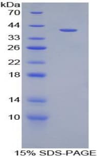 Rat MIP2 / GRO2 / CXCL2 Protein (Recombinant His-GST)