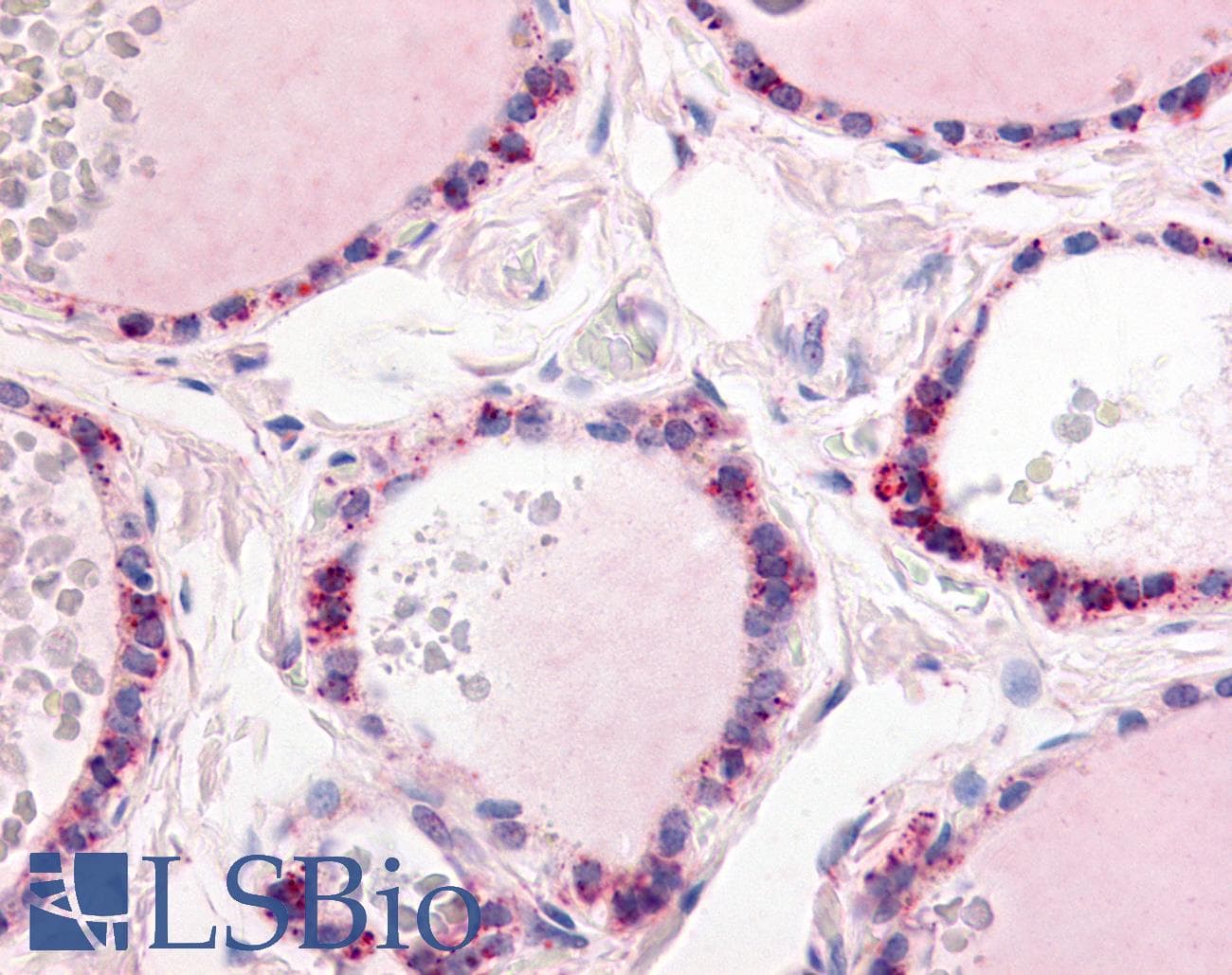 IHC-plus™ Polyclonal Rabbit anti-Human PDE1C Antibody (C-Terminus, IHC)