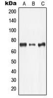 LIMK2 Antibody (Internal)