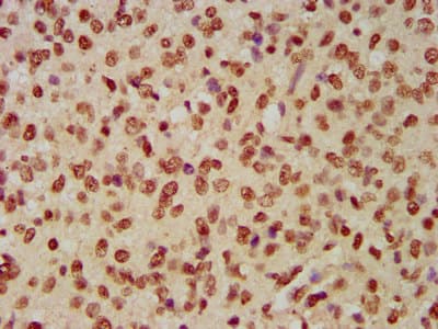 Polyclonal Rabbit anti-Human HIST1H4I Antibody (IHC)