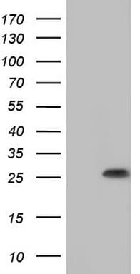 Monoclonal Mouse anti-Human SPA17 / Sperm Protein 17 Antibody (clone OTI1G1, WB)