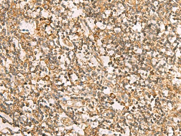 Polyclonal Rabbit anti-Human DNAJA4 Antibody (IHC, WB)