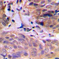 ELAVL2 / HUB Antibody (Internal)