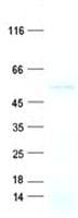 Human CPN1 Protein (Recombinant His, N-Terminal)