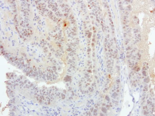 Monoclonal Mouse anti-Human S100P Antibody (clone UMAB24, IHC, IF, WB)