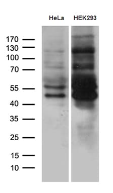 MEIS1 Antibody (aa176-390, clone OTI3G8)