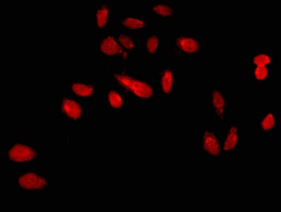 EKLF / KLF1 Antibody