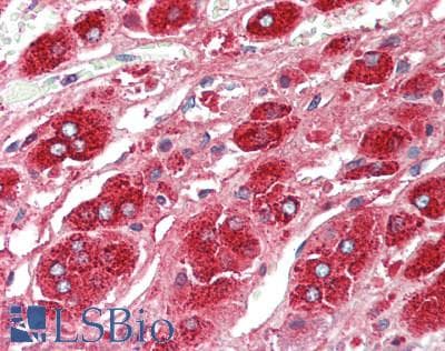 CTSA / Cathepsin A Antibody