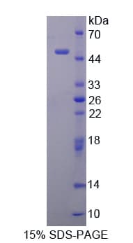 Human Smoothelin Protein (Recombinant His-GST)