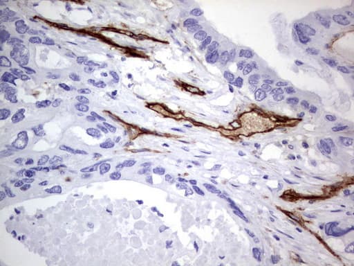 MCAM / CD146 Antibody (clone UMAB155)
