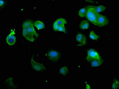 Polyclonal Rabbit anti-Human PSMD7 / MOV34 Antibody (IHC, WB)