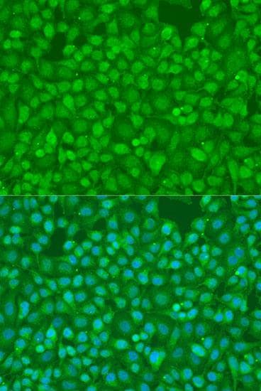 SMAD7 Antibody
