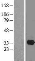 Human PITX2 / RGS Protein (Over-Expression Lysate Myc-DDK (Flag))