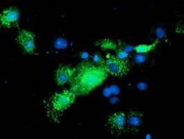 ALS2CR1 / NIF3L1 Antibody (clone OTI2B7)