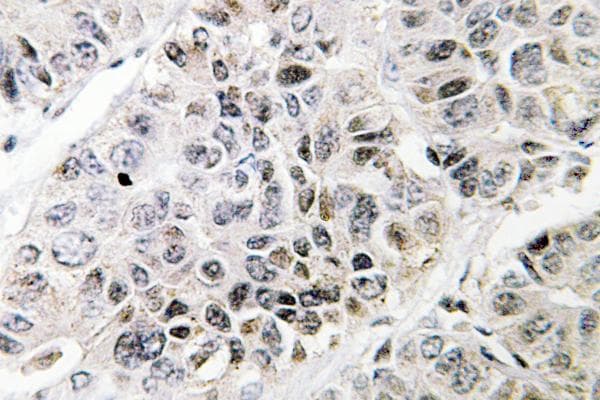 ATF3 Antibody (Asn159)