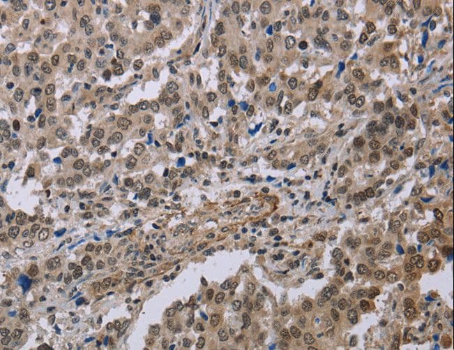 MGLL / Monoacylglycerol Lipase Antibody
