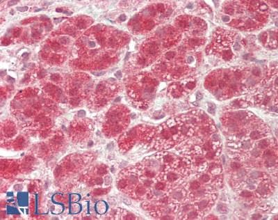 IHC-plus™ GSTT2 Antibody (aa113-141)