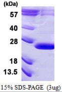 Human VPS29 Protein (Recombinant His)