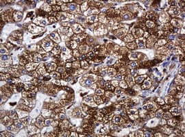 Monoclonal Mouse anti-Human POGK Antibody (clone OTI3E2, IHC, WB)