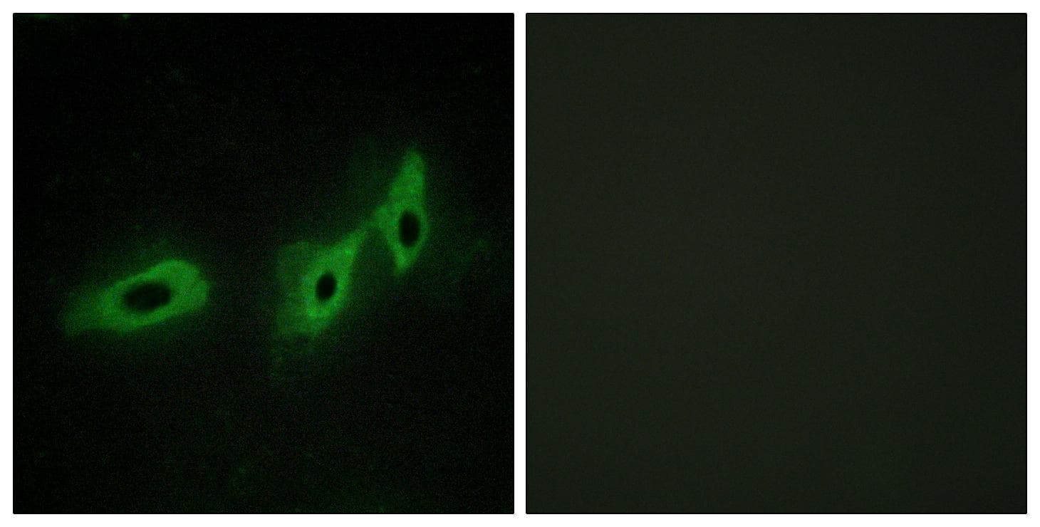 MID1 Antibody