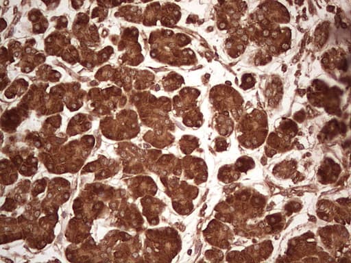 UBE2D2 / UBCH5B Antibody (clone OTI1D11)