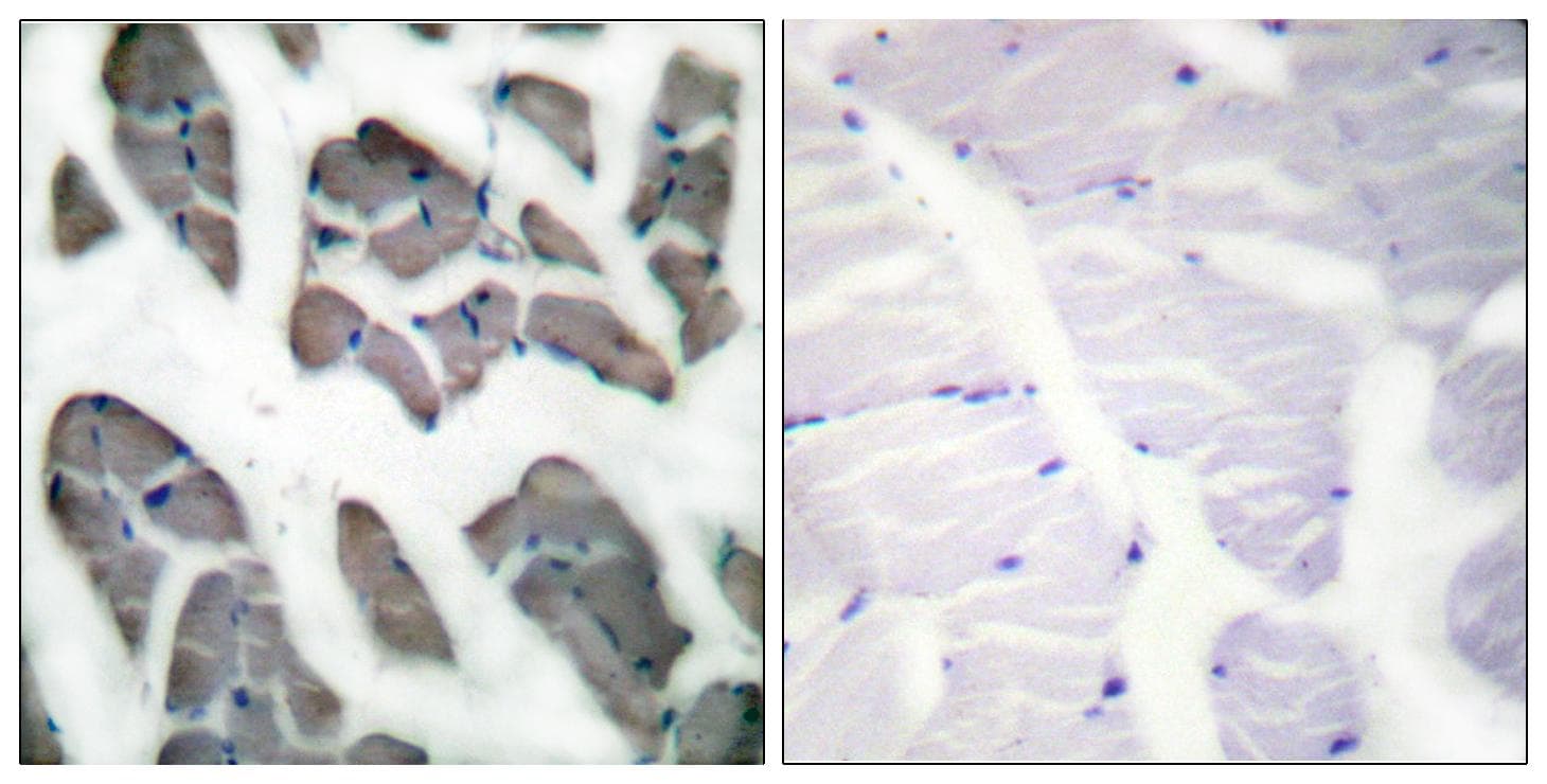 Polyclonal Rabbit anti-Human ACTG2 Antibody (IHC, WB)