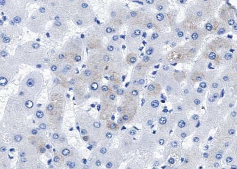 BMP5 Antibody