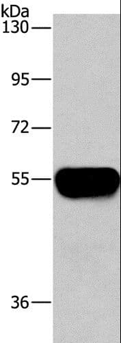 Polyclonal Rabbit anti-Human AHSG / Fetuin A Antibody (IHC, WB)