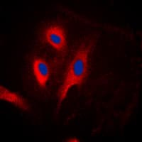 Polyclonal Rabbit anti-Human FADD Antibody (Internal, IHC, IF, WB)