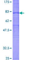 Human FZD7 / Frizzled 7 Protein (Recombinant GST)